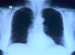 lungs-1200x900-zenmoon